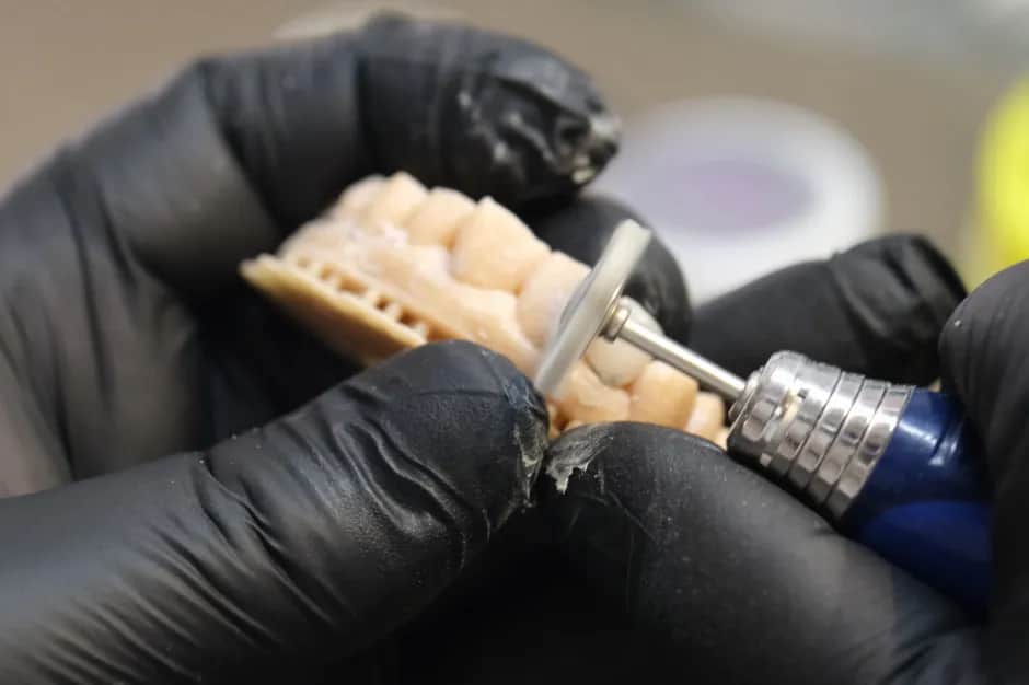 Czy implanty zębów można odliczyć od podatku? Sprawdź, jak to zrobić.