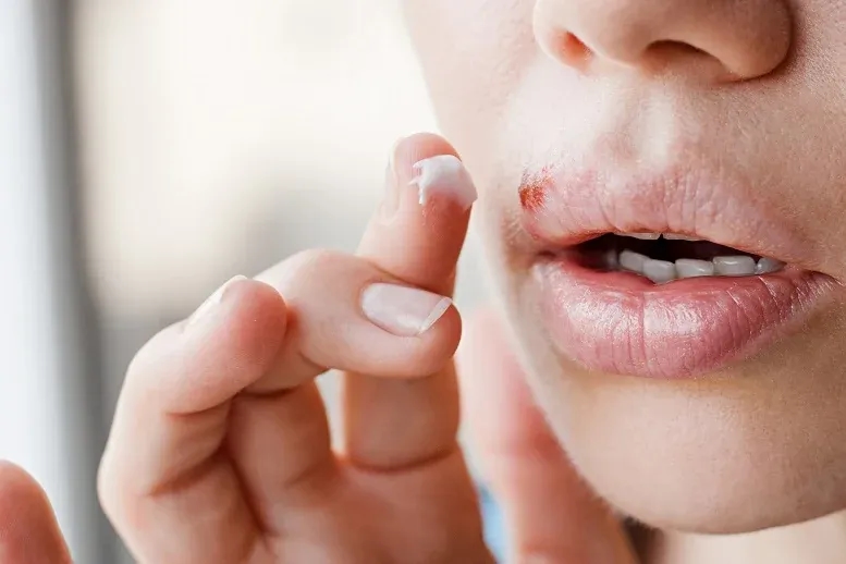 Czy z zimnem można iść do dentysty? Ryzyko i ważne informacje