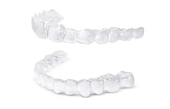 Ile kosztuje nakładka na zęby po aparacie? Sprawdź ceny i ukryte koszty