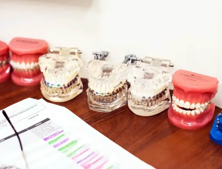 Ile kosztuje aparat na zęby ruchomy? Ceny i czynniki wpływające na koszt