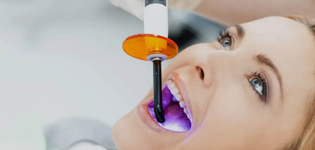 Jak wygląda wybielanie zębów u dentysty? Odkryj skuteczne metody i efekty